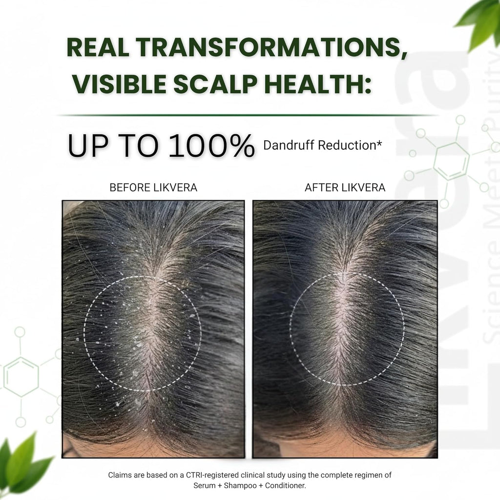 Scalp Cleansing Shampoo for Men & Women