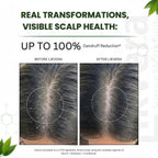 Scalp Cleansing Shampoo for Men & Women