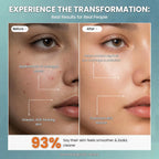 Niacinamide 10% Face Serum with Zinc PCA & Hyaluronic Acid