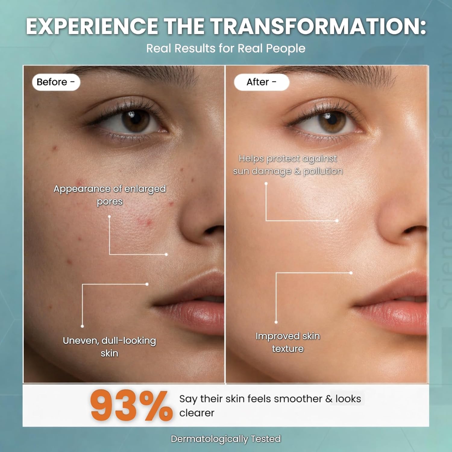 Niacinamide 10% Face Serum with Zinc PCA & Hyaluronic Acid